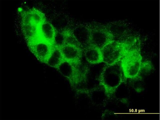 Monoclonal Anti-STEAP1 antibody produced in mouse