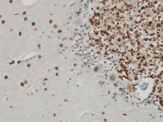 Monoclonal Anti-TPR antibody produced in mouse