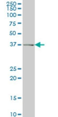 Monoclonal Anti-ADH6 antibody produced in mouse