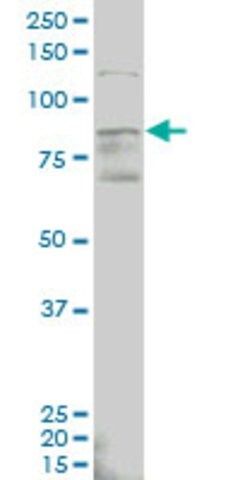 Monoclonal Anti-ALDH18A1 antibody produced in mouse