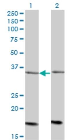 Monoclonal Anti-ADCK4 antibody produced in mouse