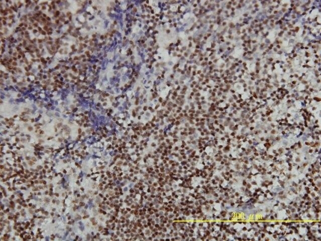 Monoclonal Anti-ANP32A antibody produced in mouse