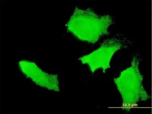 Monoclonal Anti-APC antibody produced in mouse