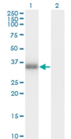 Monoclonal Anti-POMC antibody produced in mouse