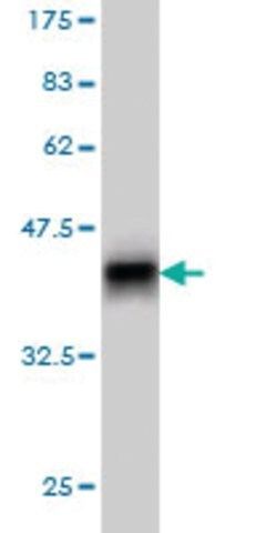 Monoclonal Anti-PPM1F antibody produced in mouse