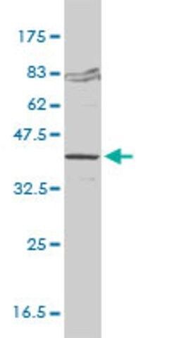 Monoclonal Anti-FVT1 antibody produced in mouse