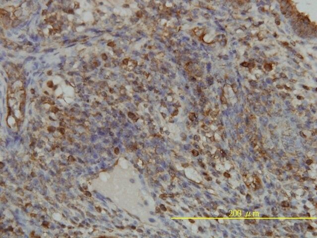 Monoclonal Anti-GART antibody produced in mouse