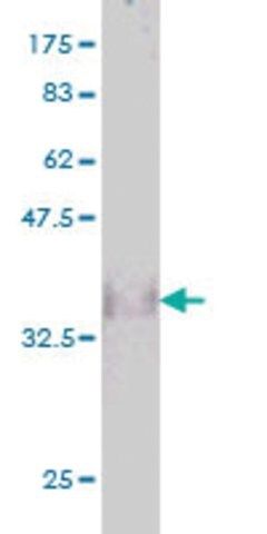 Monoclonal Anti-GAK antibody produced in mouse