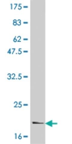 Monoclonal Anti-IL6 antibody produced in mouse