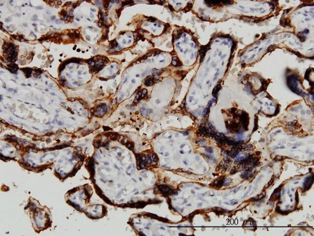 Monoclonal Anti-HSD3B1 antibody produced in mouse