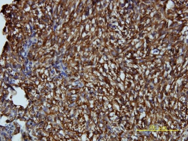 Monoclonal Anti-LDLRAP1 antibody produced in mouse