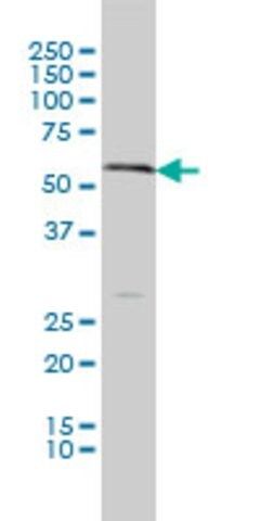 Monoclonal Anti-SLC18A1 antibody produced in mouse