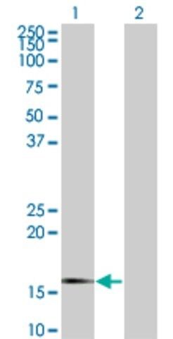 Monoclonal Anti-SNCG antibody produced in mouse