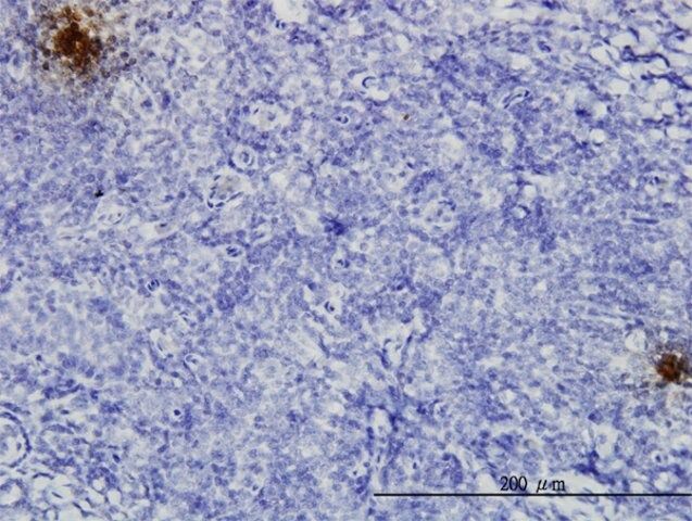 Monoclonal Anti-TFPI2 antibody produced in mouse