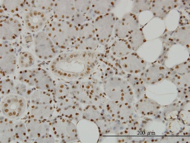 Monoclonal Anti-SPSB2 antibody produced in mouse