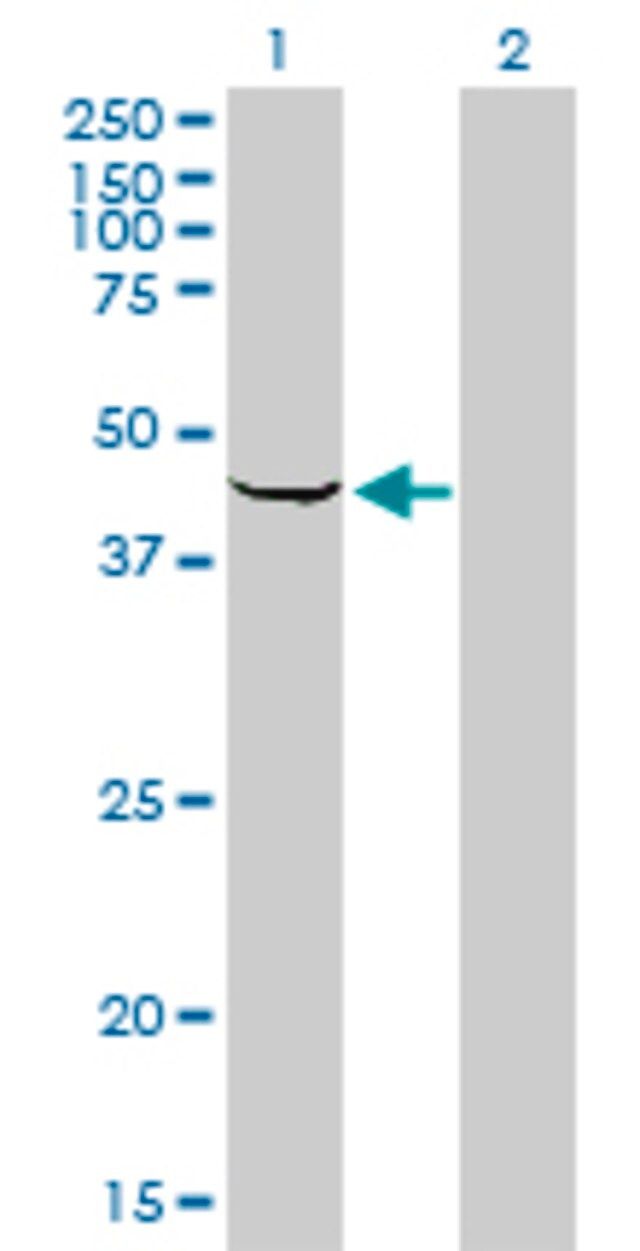 Monoclonal Anti-SPHK1 antibody produced in mouse