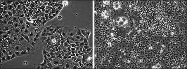 MDR1/MRP2 Double Knockout Caco-2 Cells