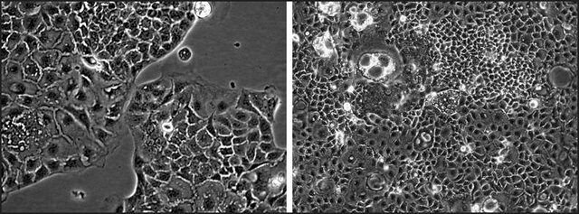 BCRP Knockout Caco-2 Cells