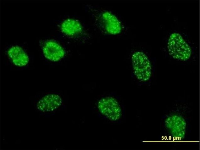 Monoclonal Anti-MSH6 antibody produced in mouse