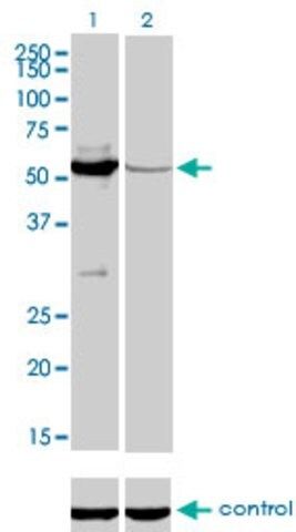 Monoclonal Anti-MUTYH antibody produced in mouse