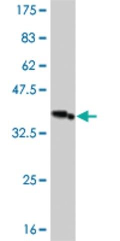 Monoclonal Anti-IRAK3 antibody produced in mouse