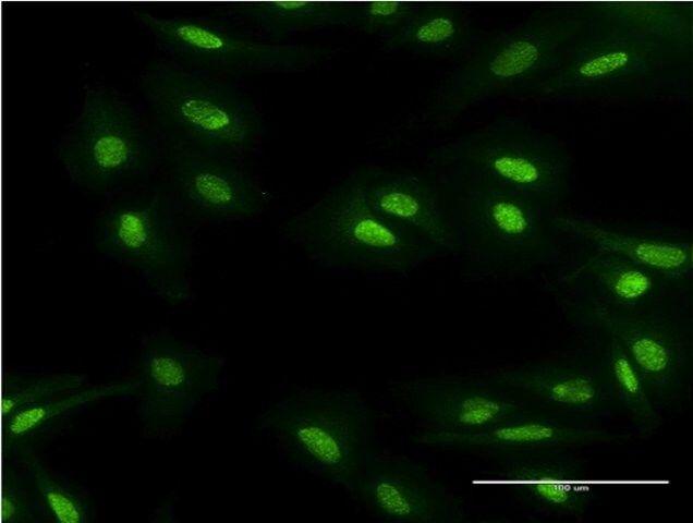 Monoclonal Anti-MBD5 antibody produced in mouse