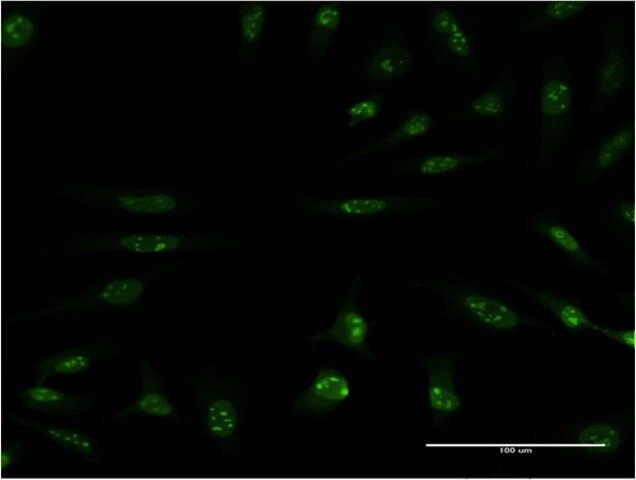 Monoclonal Anti-MAP2K5 antibody produced in mouse