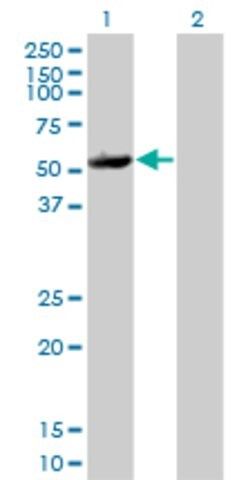 Monoclonal Anti-MAPKAPK5 antibody produced in mouse