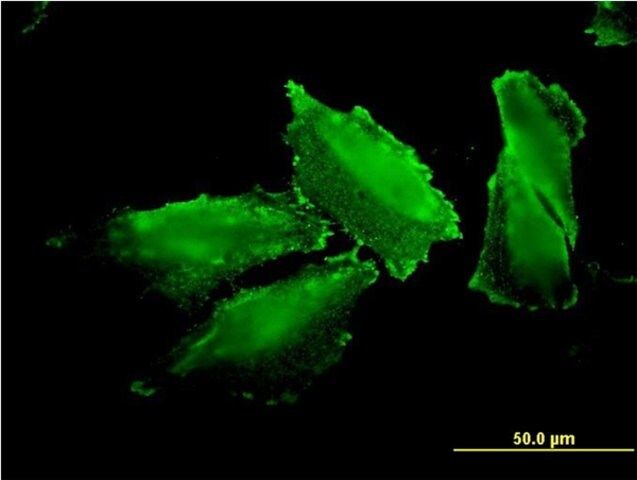 Monoclonal Anti-MARS antibody produced in mouse