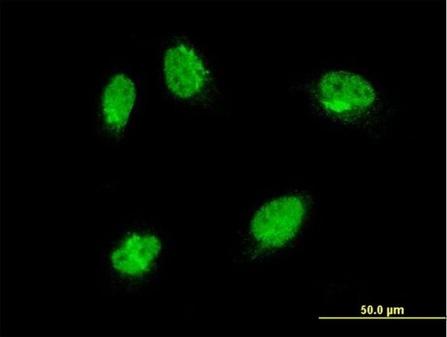 Monoclonal Anti-MAPK6 antibody produced in mouse