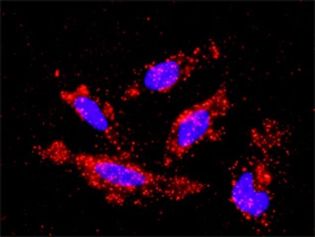 Monoclonal Anti-MAP3K1 antibody produced in mouse