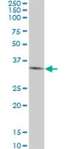 Monoclonal Anti-DKK1 antibody produced in mouse