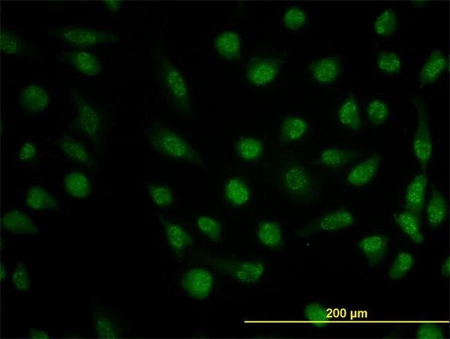 Monoclonal Anti-DHFR antibody produced in mouse