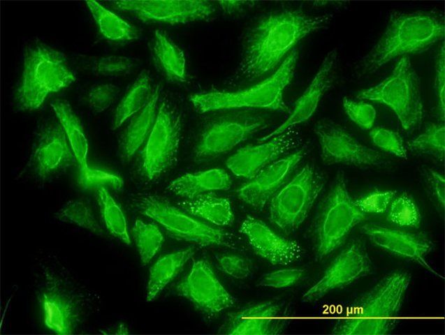 Monoclonal Anti-DCUN1D1 antibody produced in mouse