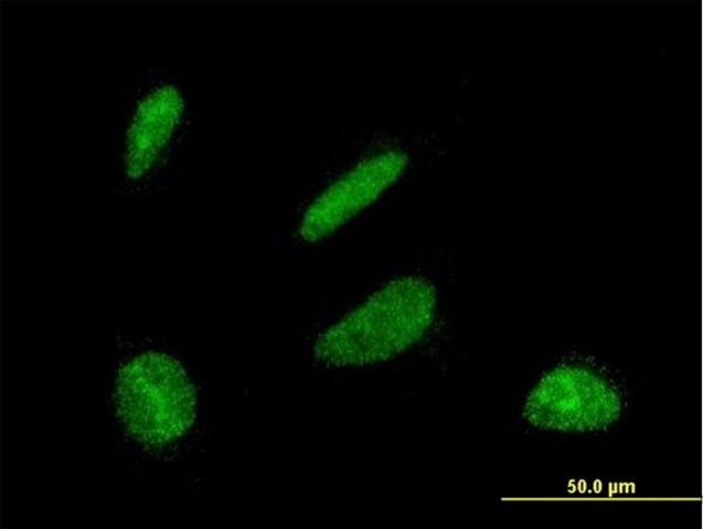 Monoclonal Anti-DBF4 antibody produced in mouse