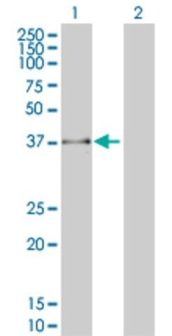 Monoclonal Anti-FBXO25 antibody produced in mouse