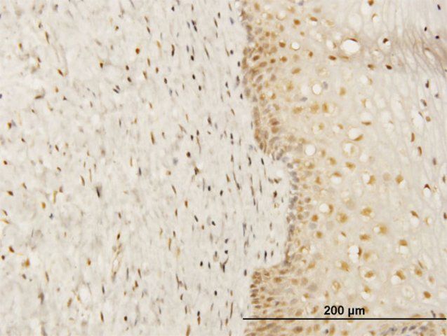 Monoclonal Anti-FKBP4 antibody produced in mouse