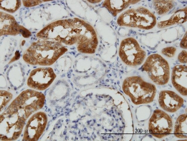 Monoclonal Anti-FTCD antibody produced in mouse