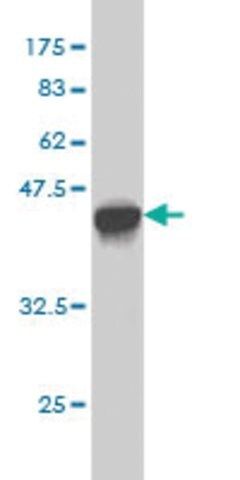 Monoclonal Anti-GAA antibody produced in mouse