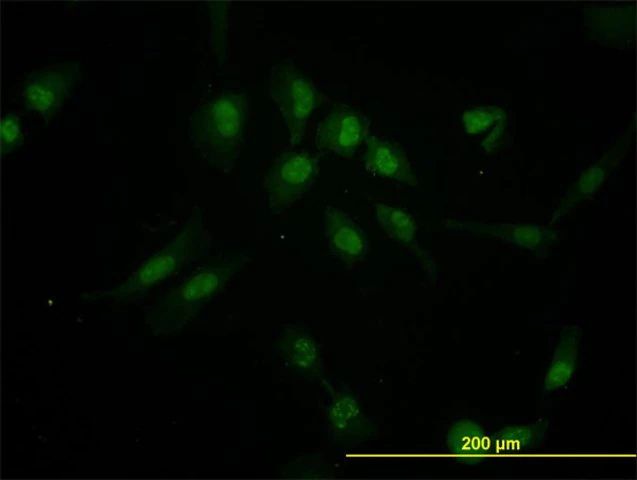 Monoclonal Anti-IRX5 antibody produced in mouse