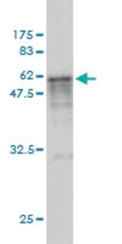 Monoclonal Anti-CASQ2 antibody produced in mouse