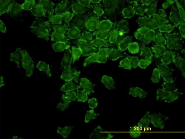 Monoclonal Anti-CAP2 antibody produced in mouse