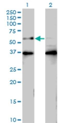 Monoclonal Anti-BTBD9 antibody produced in mouse