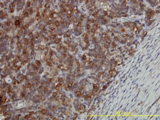 Monoclonal Anti-CCT5 antibody produced in mouse