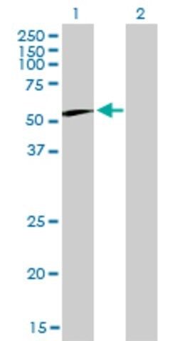 Monoclonal Anti-CCT6B antibody produced in mouse