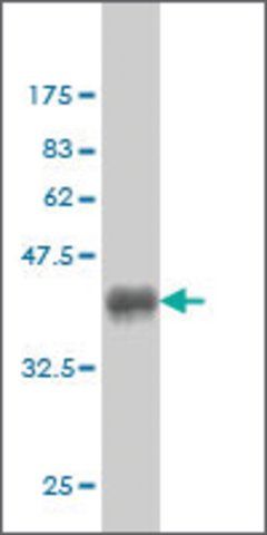 Monoclonal Anti-CHN1 antibody produced in mouse