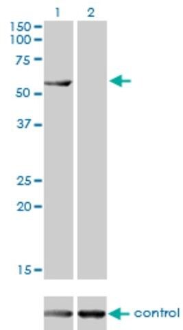 Monoclonal Anti-CESK1 antibody produced in mouse