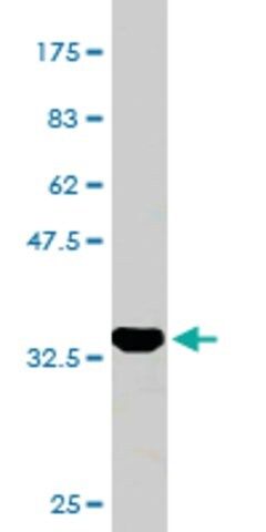 Monoclonal Anti-CGB7 antibody produced in mouse