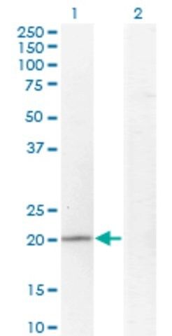 Monoclonal Anti-CGI-121 antibody produced in mouse