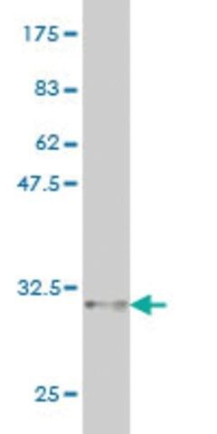 Monoclonal Anti-CDSN antibody produced in mouse